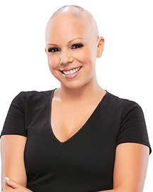 Model Melissa Before image with no hair